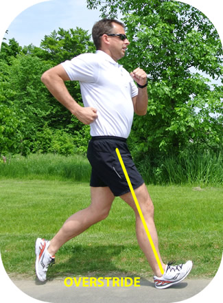 Overstriding can cause runner's knee