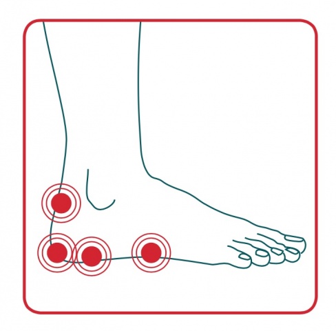 areas of the foot affected by achilles tendinitis