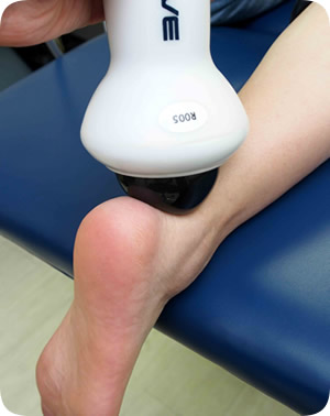 Shock wave therapy can ease achilles tendonitis pain 