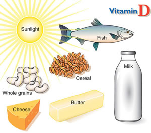 Vitamin D can lower back pain levels