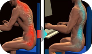 Poor posture can lead to bulging disc pain