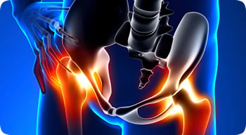 Snapping hip Syndrome can take you out of the dance