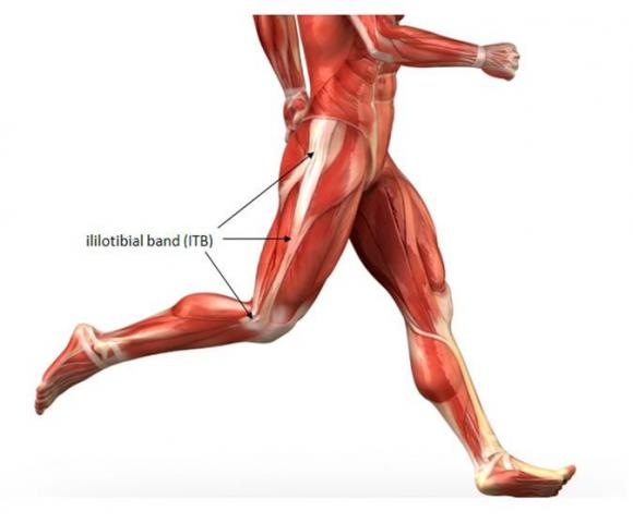 IT Band Syndrome affects millions of runners