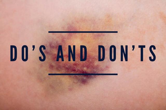 Do's and Don'ts for treating a bruise