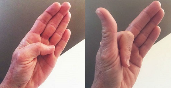 hand-exercises-reduce-arthritis-pain