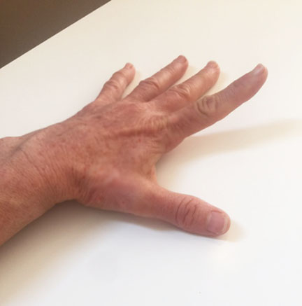 prevent-hand-pain-finger-lift