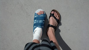 feet-prone-to-stress-fractures