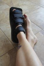 treat-stress-fracture-foot
