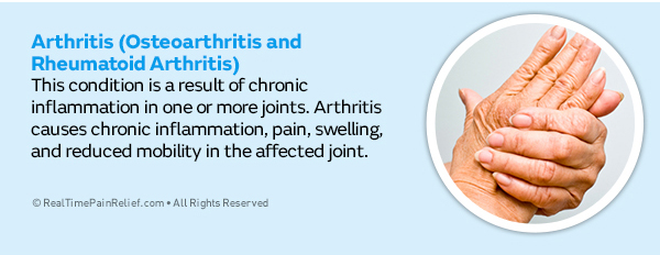 arthritis is a type of hand pain