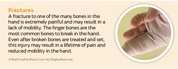 Fractures-hand-pain